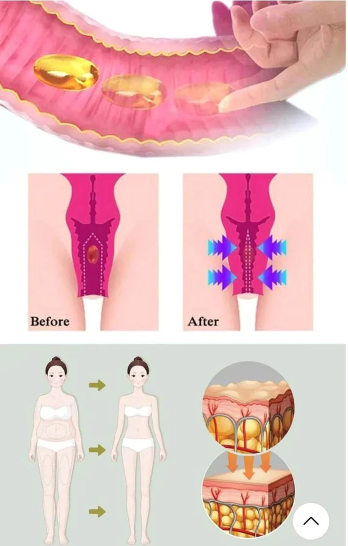 Gélules BioNaturelles de réparation vaginale.